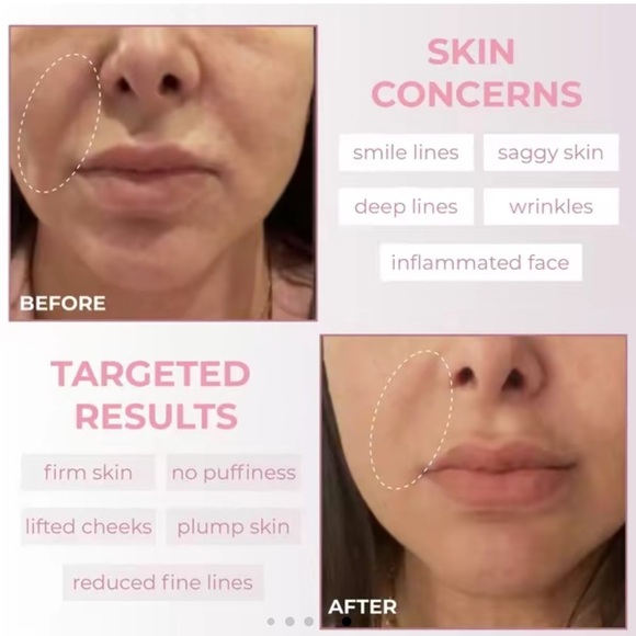 Riki Sculptress Face and Body Massage Tool - Picture 7 of 8